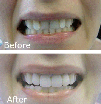 before-and-after mg dental