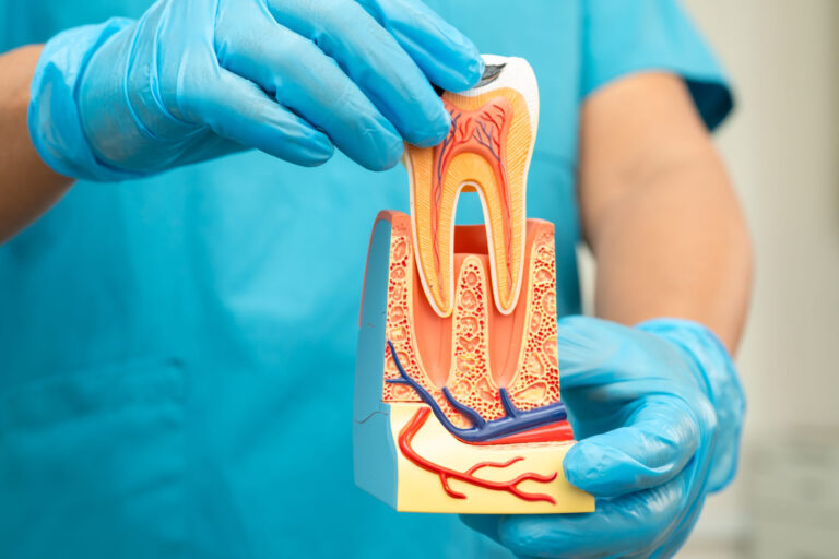 root canal therapy at ferntree gully dentist root canal therapy at ferntree gully dentist