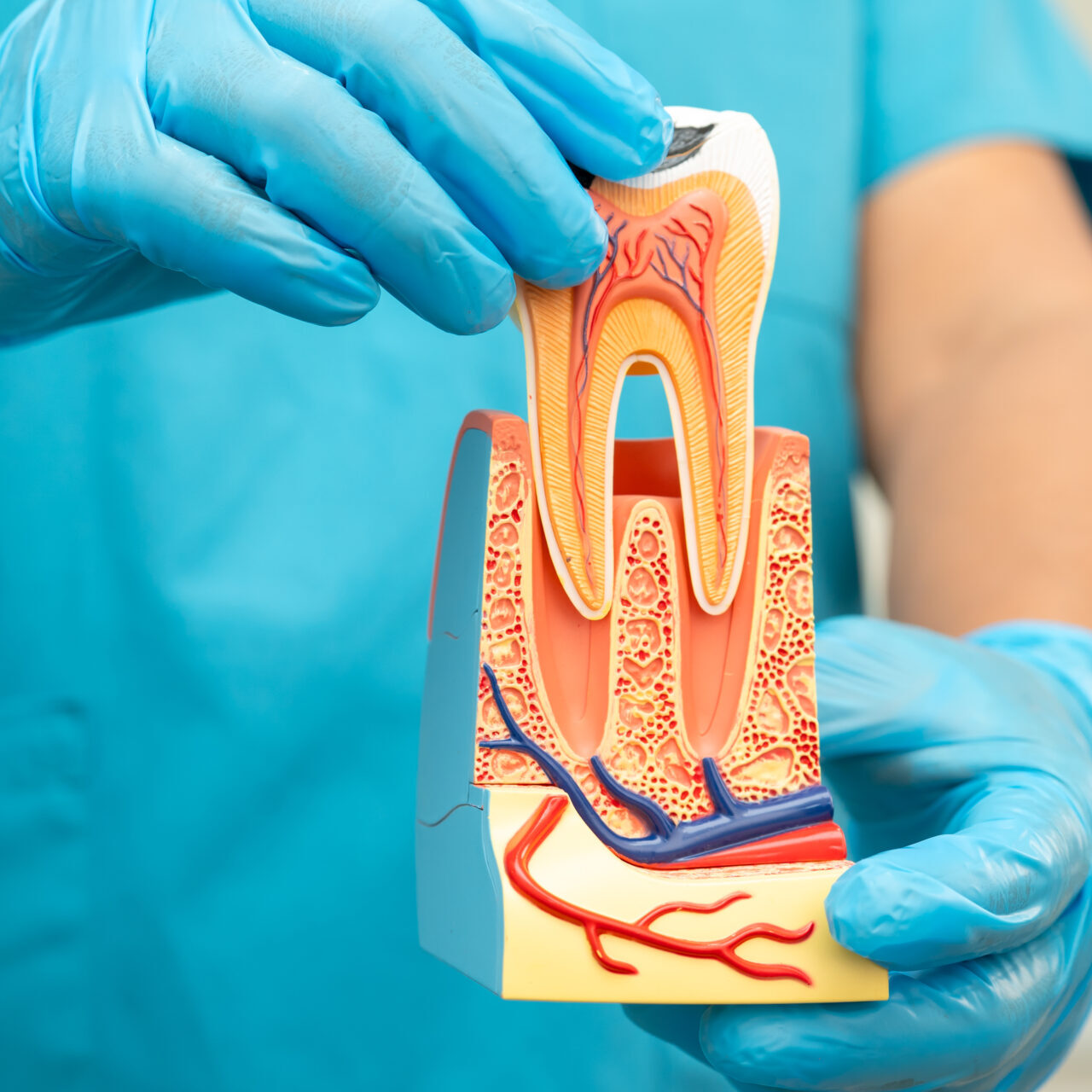 root canal therapy at ferntree gully dentist
