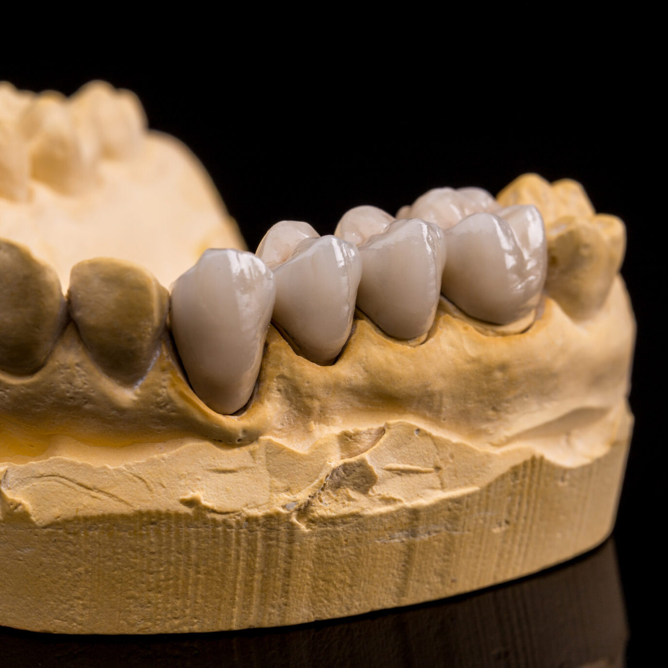 Ferntree Gully Dentist