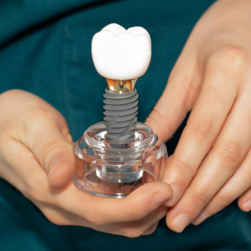 dental implants at ferntree gully dentist