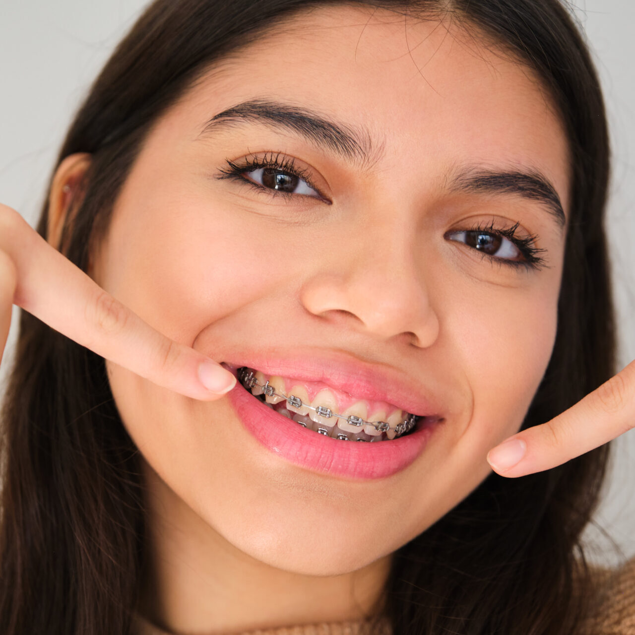braces at ferntree gully dentist