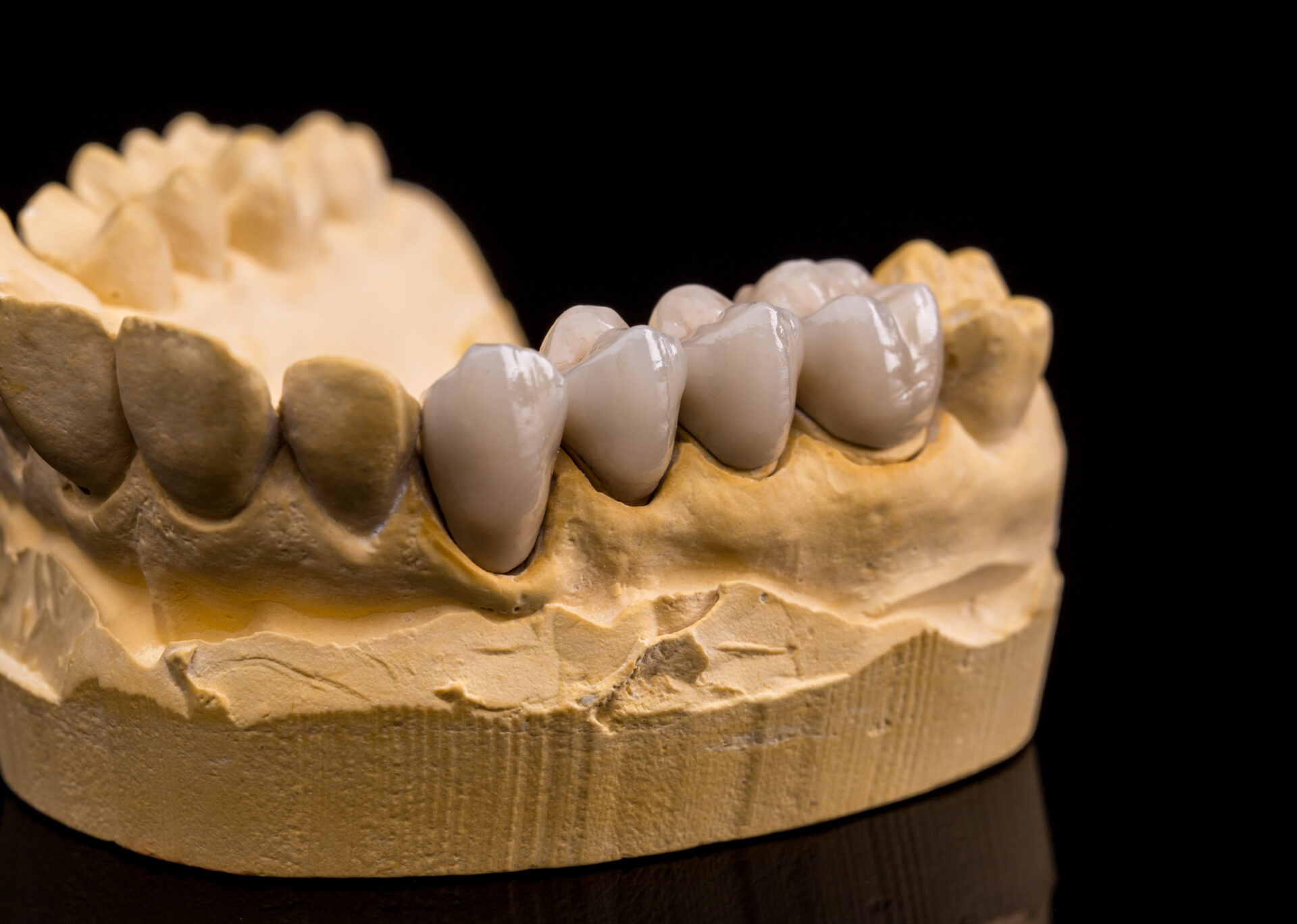 Ferntree Gully Dentist