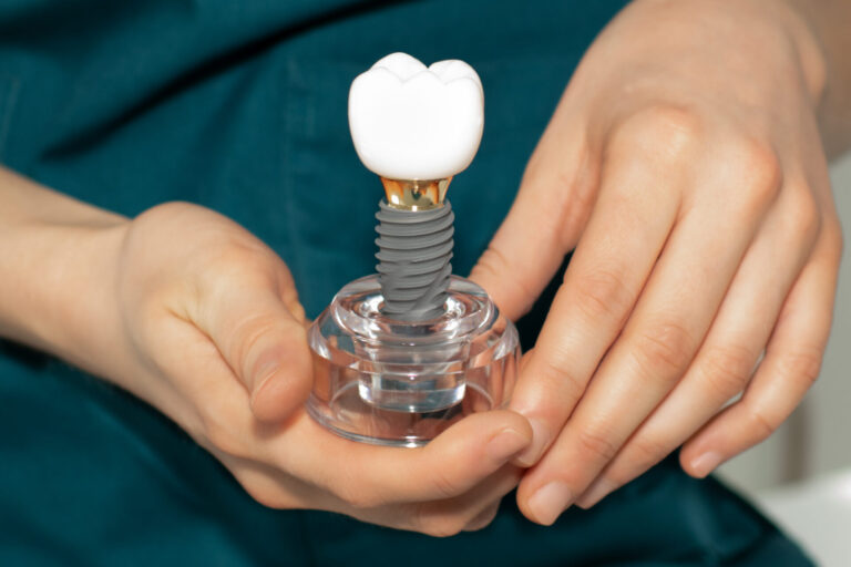dental implants at ferntree gully dentist dental implants at ferntree gully dentist