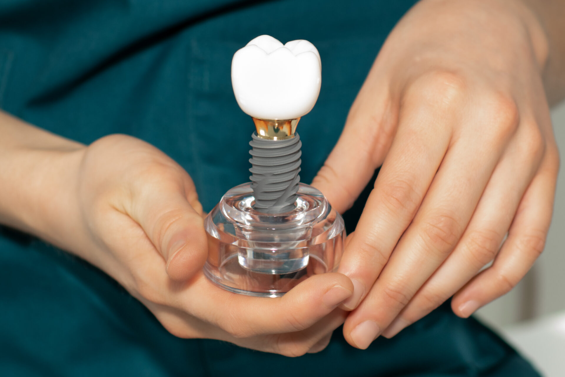 dental implants at ferntree gully dentist
