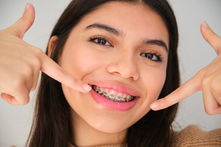 braces at ferntree gully dentist braces at ferntree gully dentist