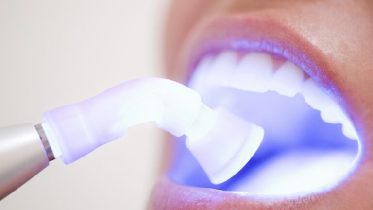 Ferntree Gully Dentist Ferntree Gully Dentist