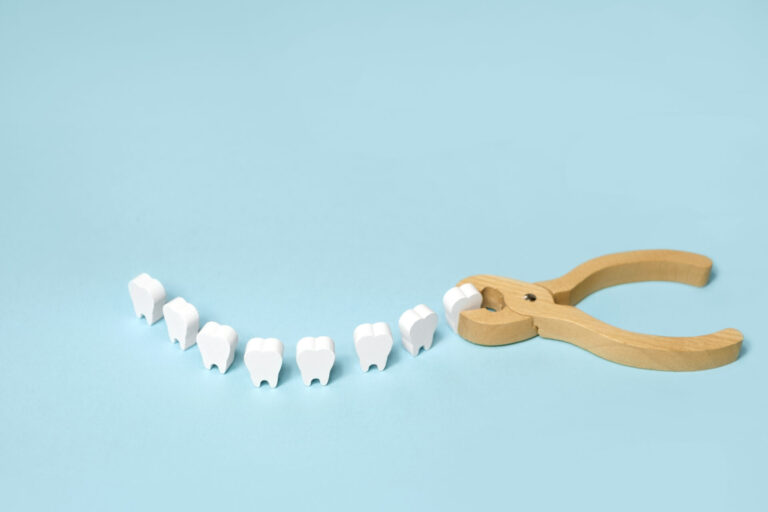 tooth extractions at ferntree gully dentist tooth extractions at ferntree gully dentist